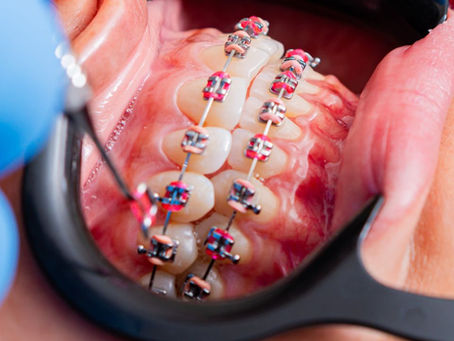What Does an Orthodontist Do
