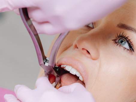 Periodontal Treatments