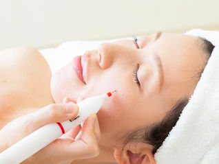 10分 しみ取り放題！★お肌のターンオーバーを促す低周波ペンシル★ 