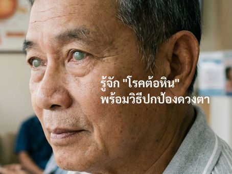เรื่องเล่าจากหมอสายตา: รู้จัก "โรคต้อหิน" พร้อมวิธีปกป้องดวงตา