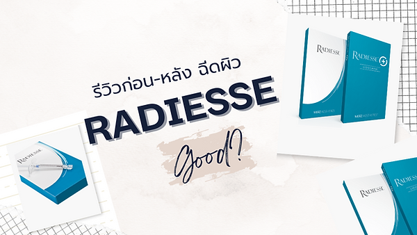 รีวิวก่อน/หลัง ฉีดผิว Radiesse (เรเดียส) ราคาเริ่มต้นเพียง 32,900 บาท