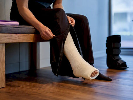 Person dressing around a broken ankle cast