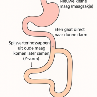 tekening uitleg van mijn gastric bypass