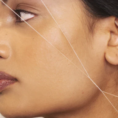 Sideburn Threading at Elegant Laser & Aesthetics