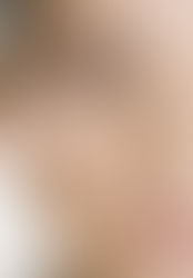 Corretivo ideal para cada tipo de pele