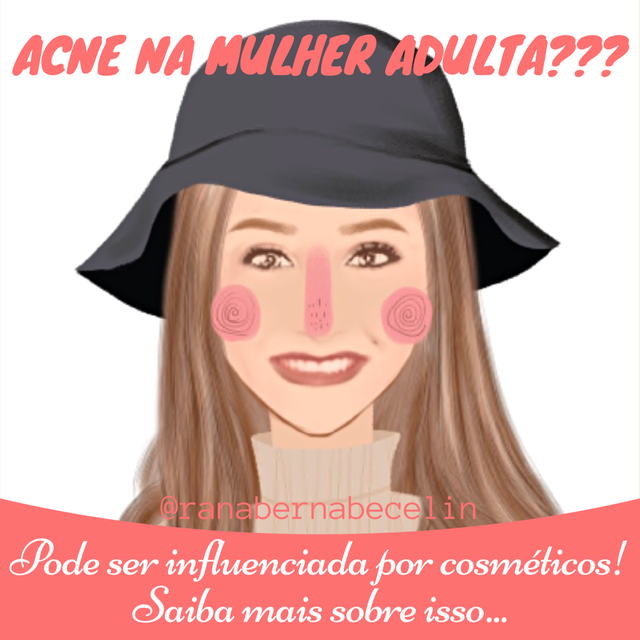Acne na mulher adulta! Saiba mais sobre isso.