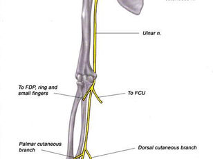 CHÈN ÉP THẦN KINH TRỤ