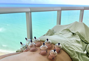 sarai cupping_edited.jpg