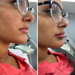 326918814_575555730734782_7937197324947063464_n