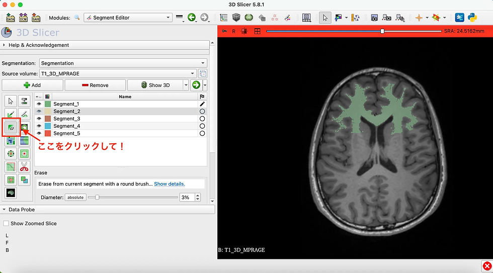 消しゴムの選択