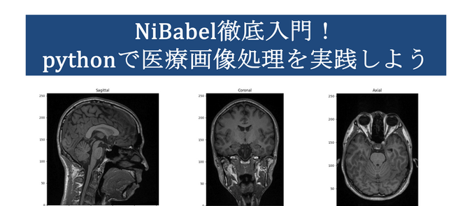 NiBabel徹底入門!pythonで医療画像処理を実践しよう