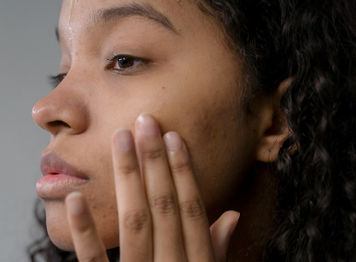 Black White Simple Illustrated 5 Ways To Fade Acne Scars Instagram Post_edited.jpg