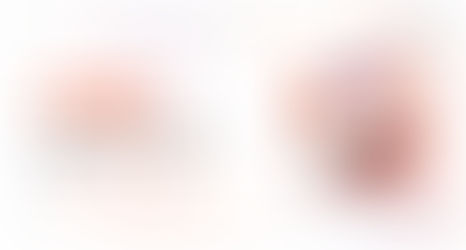 IP PBX with Auto Provisioning: Simplifying Communication Setup