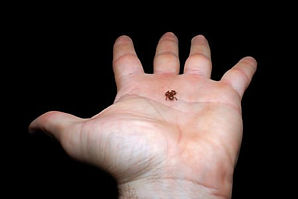 Discover the world of extreme biodiversity with the recently discovered Flea Toad in the Amazon. It's the second smallest vertebrate known.