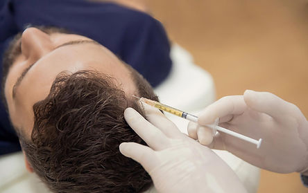 men's scalp during hair restoration treatment