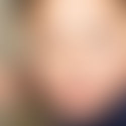 Çocuklarda öfke nedenlerini anlamak ve öfke kontrolünü sağlamak zor olabilir. Çocuğum çok agresif ya da öfke patlaması yaşıyor diyorsanız, öfkeli çocuğa nasıl davranmalı sorusunun cevabını arıyorsunuzdur. Çocuğun öfkesini dindirme ve sakinleşme teknikleri hakkında pratik önerilerimizle çocuğunuzla daha iyi bir ilişki kurabilir, çocukta öfke ne zaman biter sorusunun cevabını bulabilirsiniz.