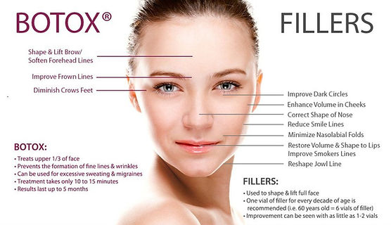 Benefits of Botox and fillers