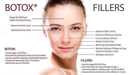 Benefits of Botox and fillers