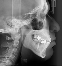 radiographie orthodontie