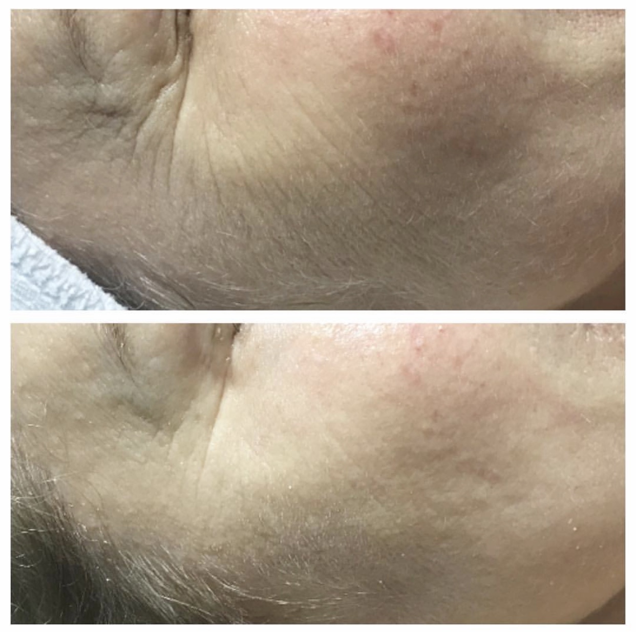 Environ | Dermalux