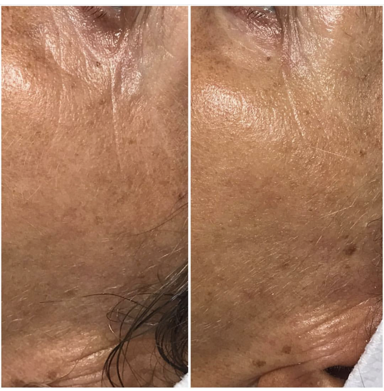 Environ | Dermalux