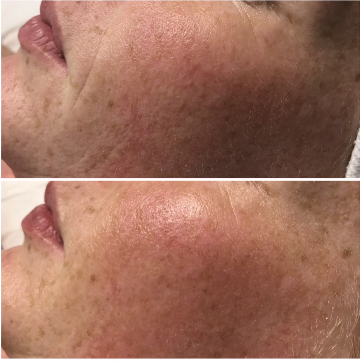 Environ | Dermalux