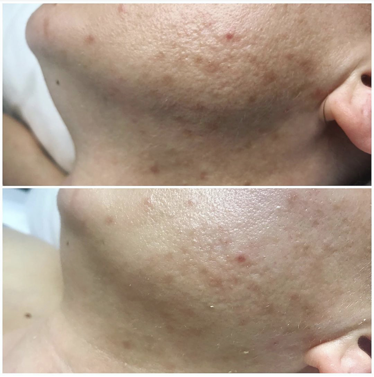 Environ | Dermalux