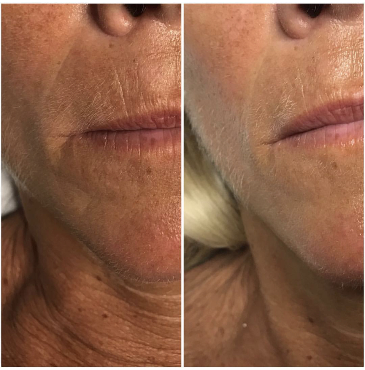 Environ | Dermalux