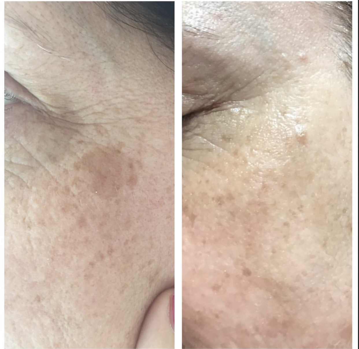 Environ | Dermalux