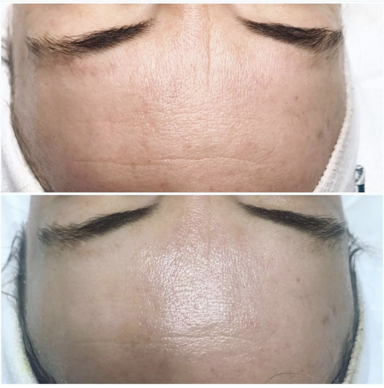 Environ | Dermalux