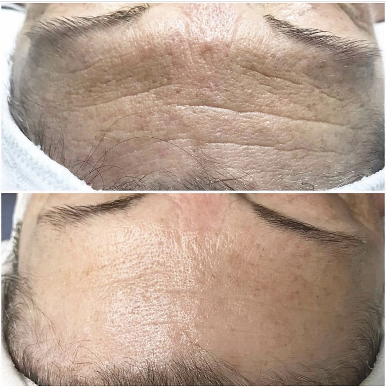Environ | Dermalux