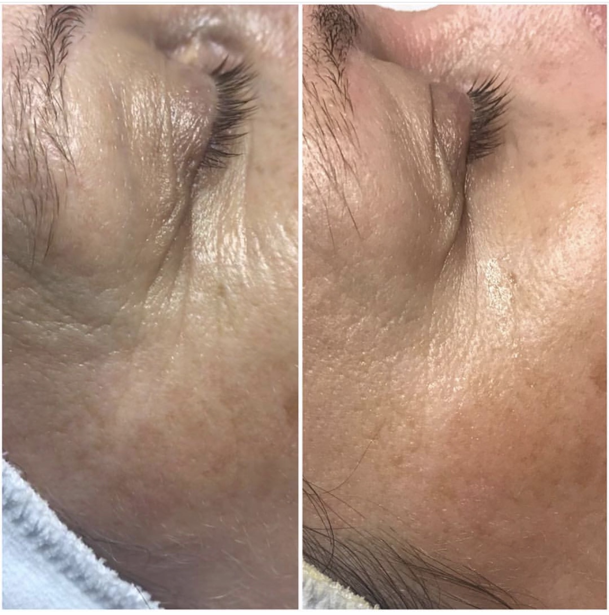 Environ | Dermalux