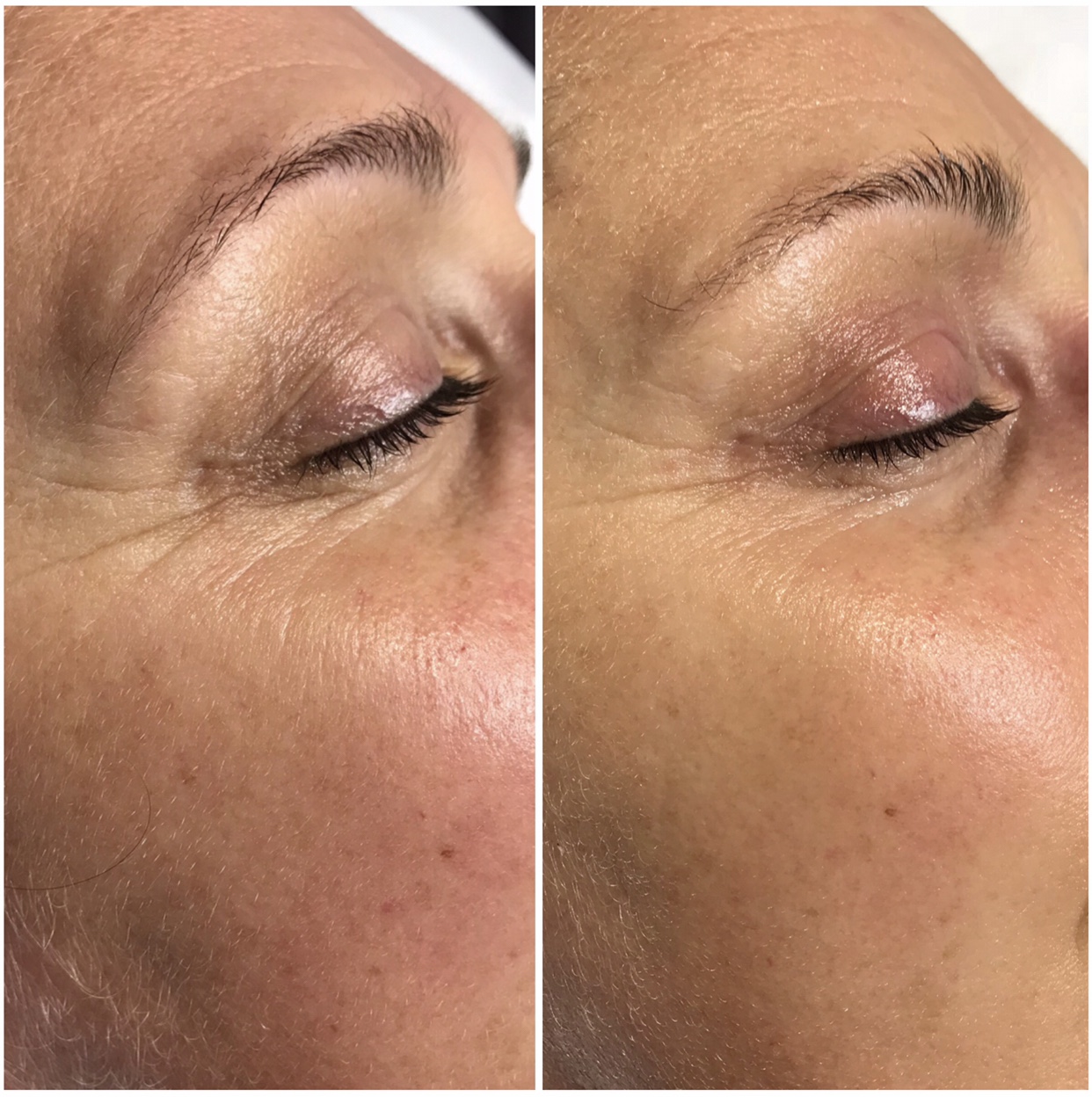 Environ | Dermalux