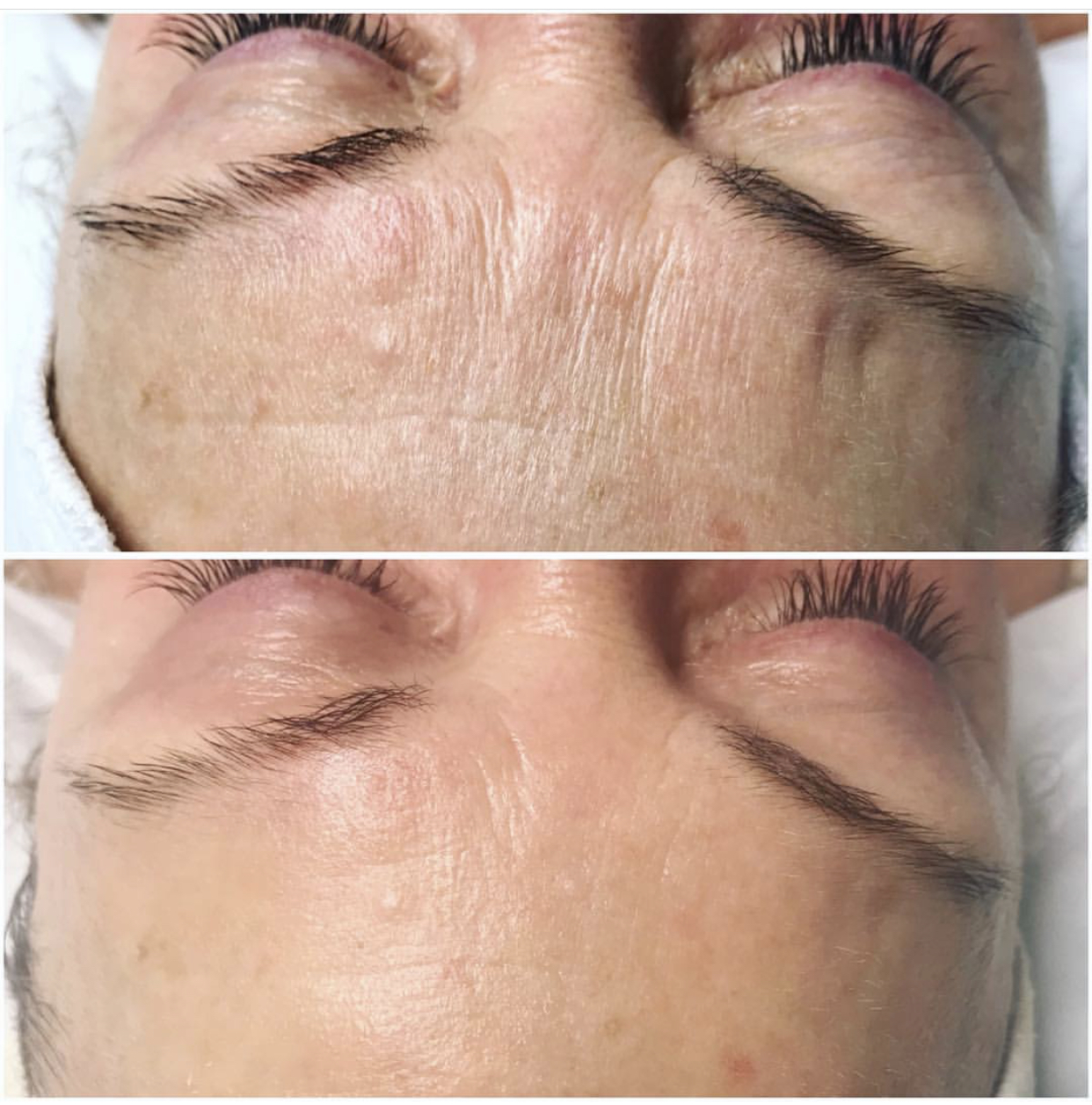 Environ | Dermalux