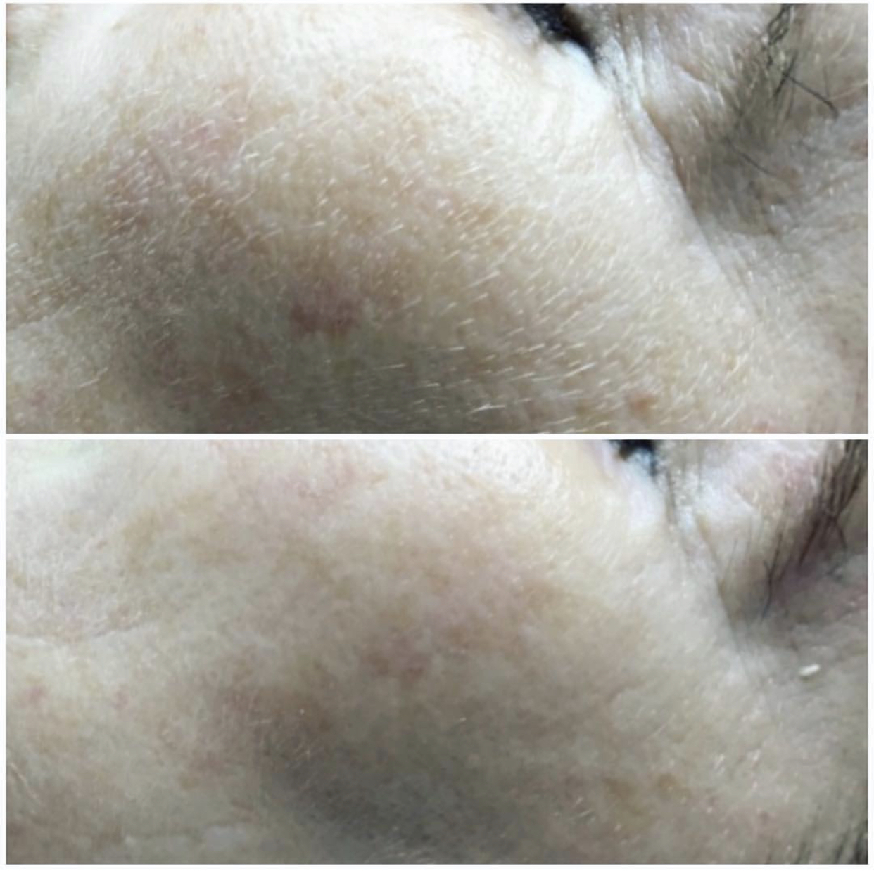 Environ | Dermalux