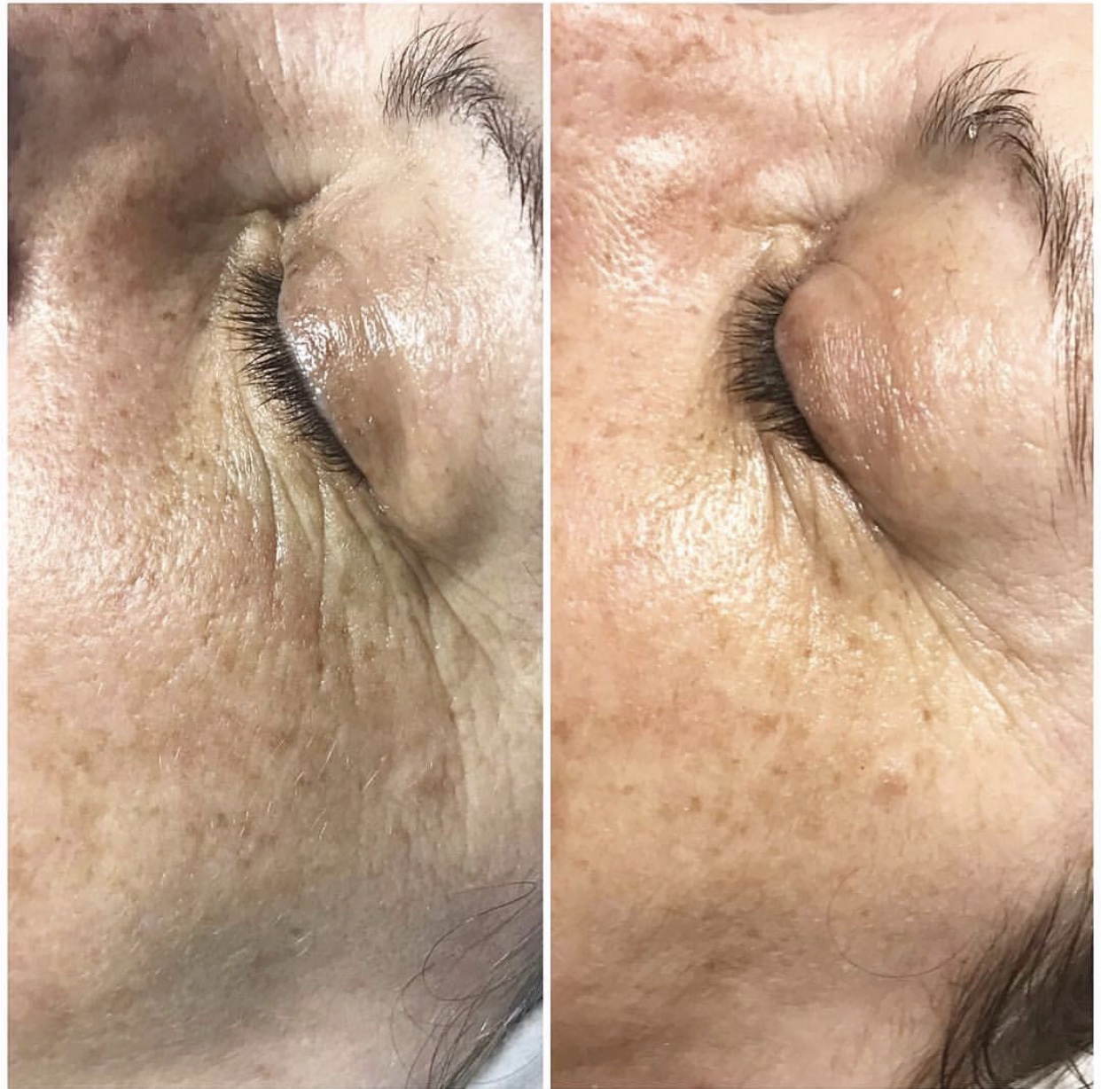 Environ | Dermalux