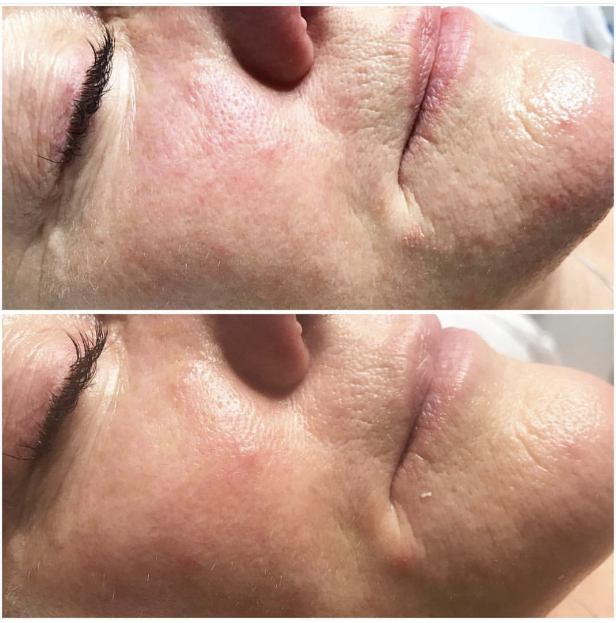 Environ | Dermalux