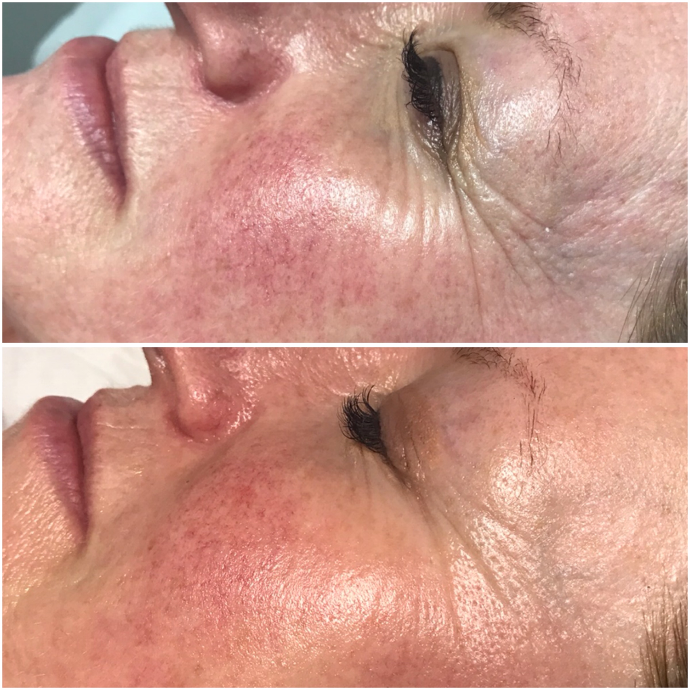 Environ | Dermalux
