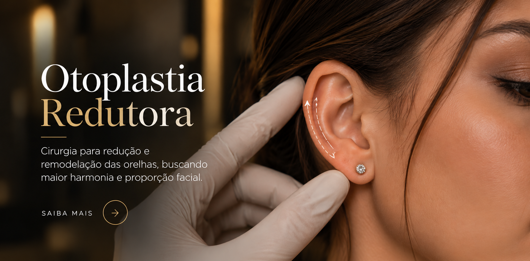Otoplastia Redutora 