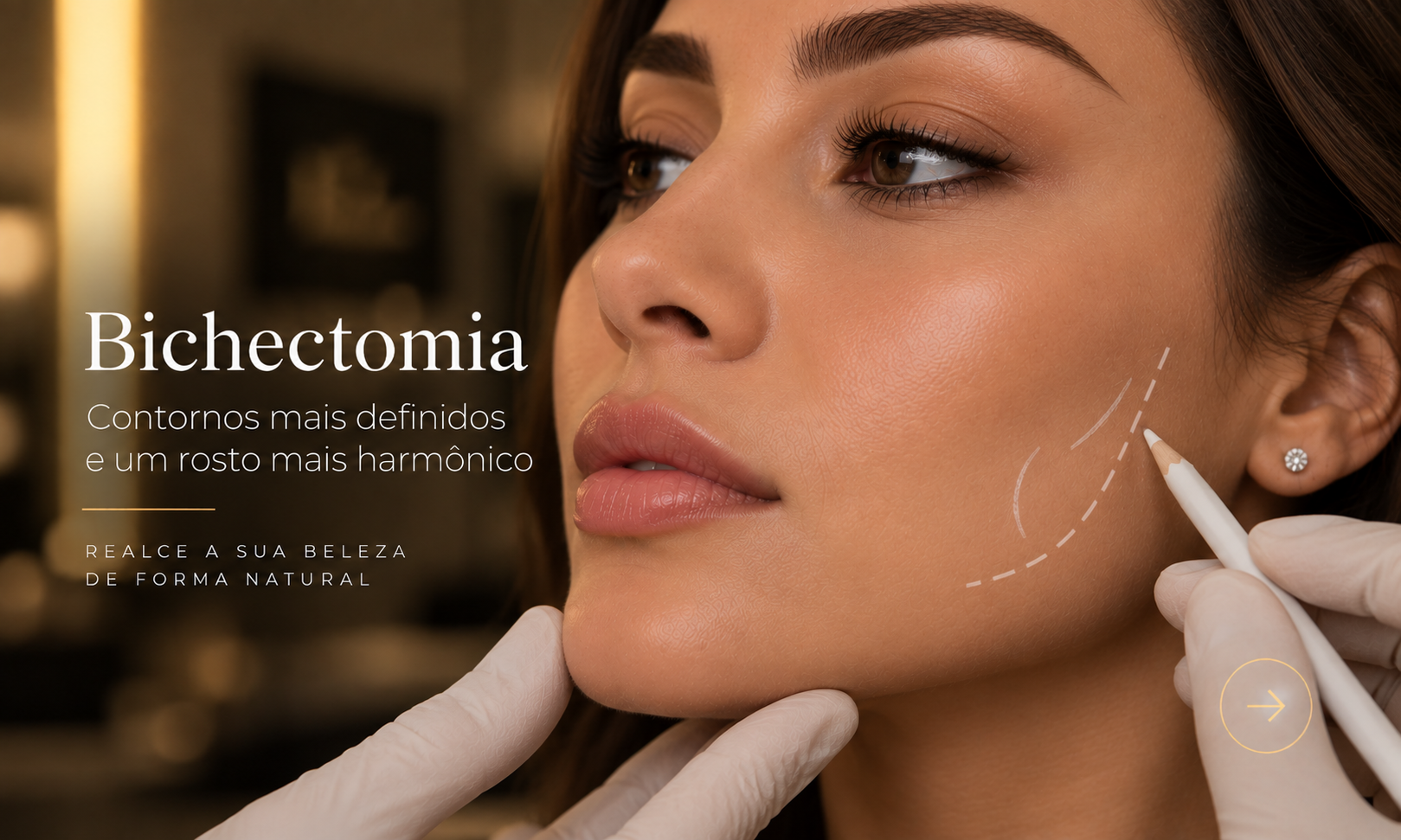 Bichectomia 
