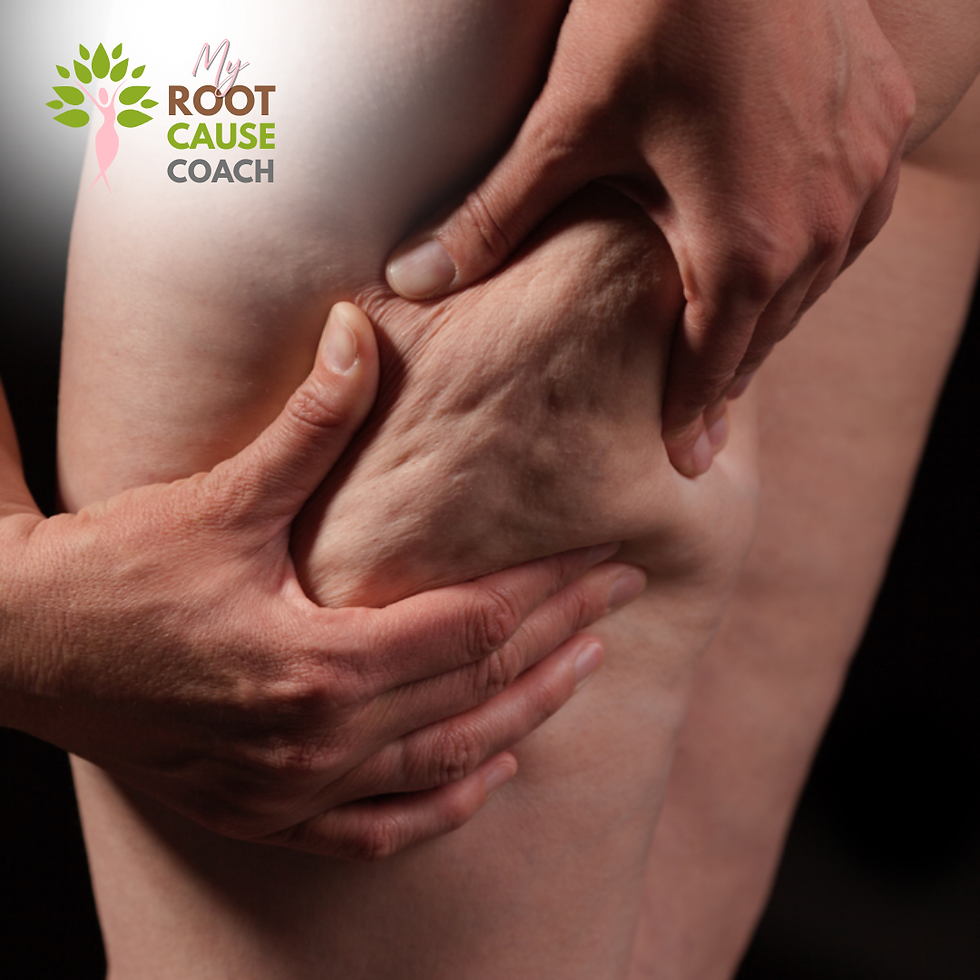 Hands massage a bare thigh against a dark background, with My Root Cause Coach logo in the corner.