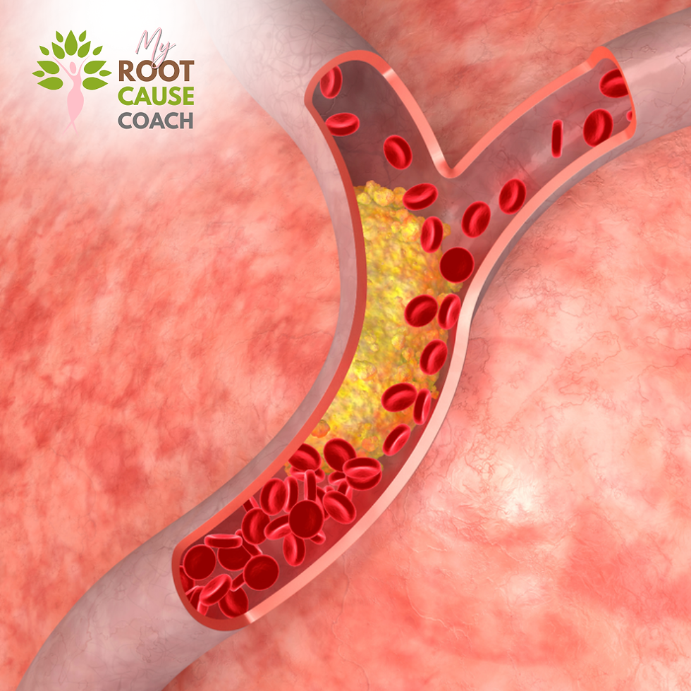 Illustration of a clogged artery with plaque and red blood cells, beside the logo text My Root Cause Coach.