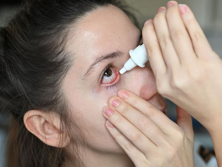 Ayurveda for Dry, Burning Eyes | Vata and Pitta and Your Peepers
