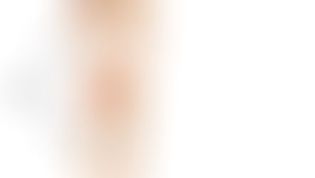 The Rising Concern of ACL Injuries in Sports: Causes and Preventive Measures Using Mbody