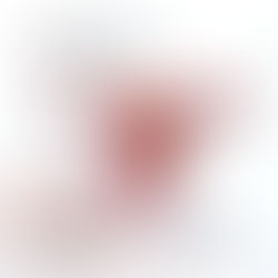 Endometriose e Miomas: é possível preservar o útero?