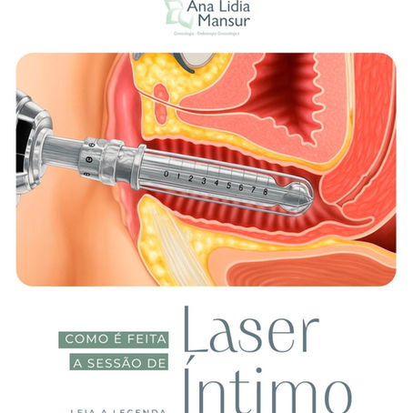 Como é a sessão de Laser Íntimo?