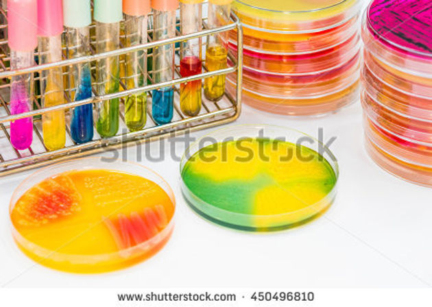 stock-photo-the-buffer-in-beaker-and-bacteria-culture-growth-on-selective-media-plate-biochem-test-k