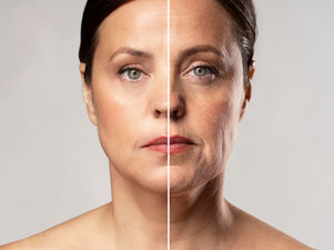 טיפולי עור הם לא פלסטר, אלא תהליך לכל דבר 