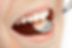 dentistica_restaruadora_1.jpg