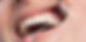 periodontia.jpg